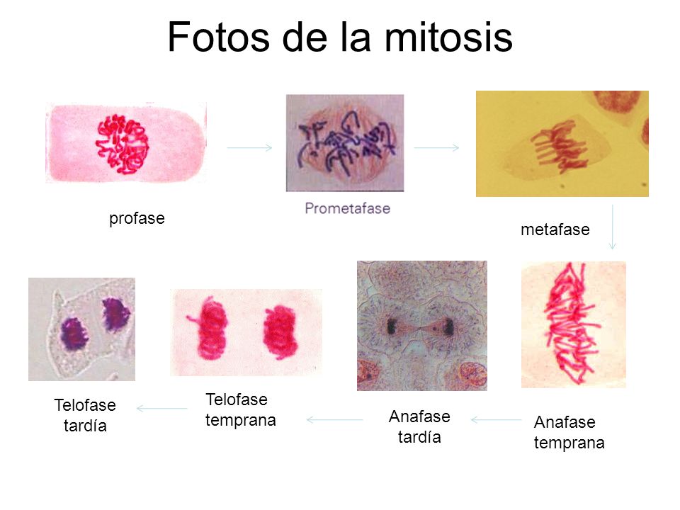 Del calcio glyukonat en el tratamiento de la psoriasis